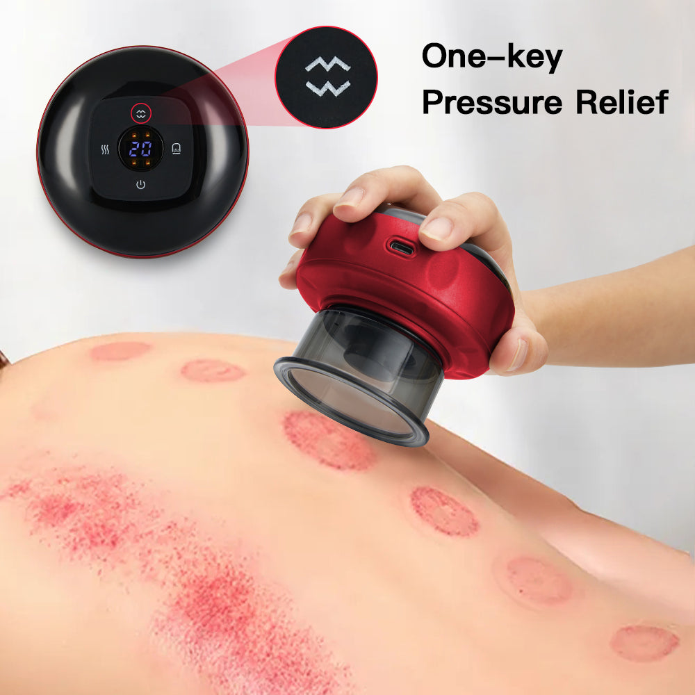 New Cupping Therapy